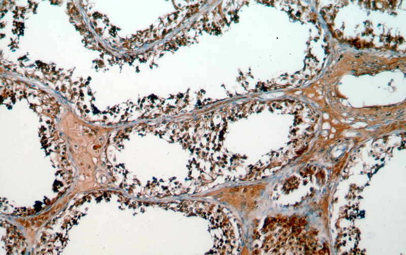 Immunohistochemical of paraffin-embedded human testis using Catalog No:115526(SPA17 antibody) at dilution of 1:50 (under 10x lens)