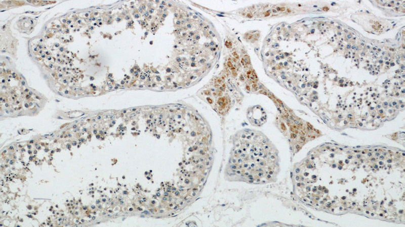 Immunohistochemical of paraffin-embedded human testis using Catalog No:112809(MRPL10 antibody) at dilution of 1:50 (under 10x lens)