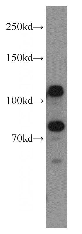 HeLa cells were subjected to SDS PAGE followed by western blot with Catalog No:109951(DNAJC6 antibody) at dilution of 1:800
