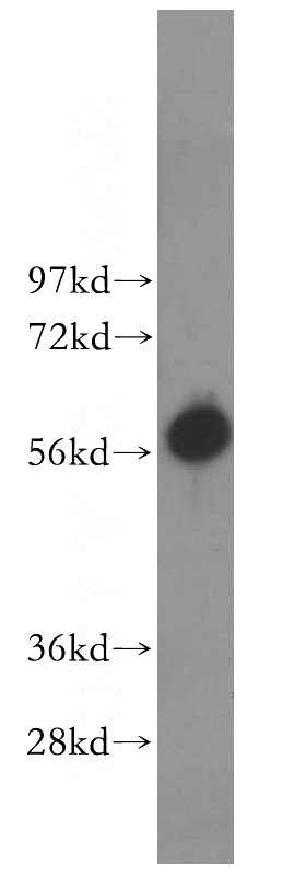 A375 cells were subjected to SDS PAGE followed by western blot with Catalog No:114193(PRIM2 antibody) at dilution of 1:500