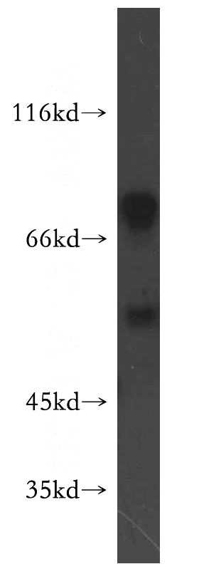 HepG2 cells were subjected to SDS PAGE followed by western blot with Catalog No:114395(PSMD12 antibody) at dilution of 1:100