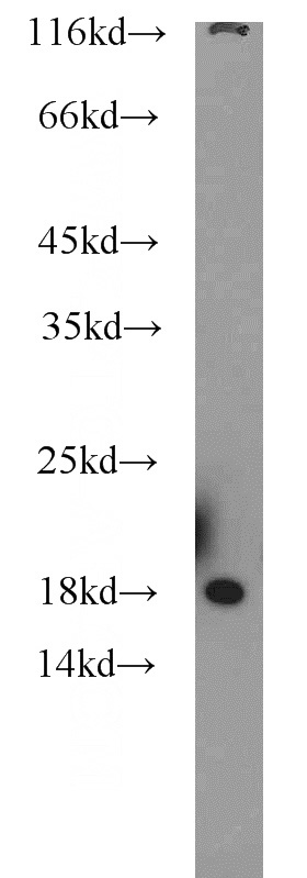 mouse liver tissue were subjected to SDS PAGE followed by western blot with Catalog No:114883(RPL27 antibody) at dilution of 1:500