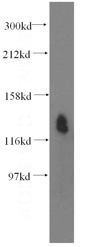 HeLa cells were subjected to SDS PAGE followed by western blot with Catalog No:115299(SLC12A4 antibody) at dilution of 1:400
