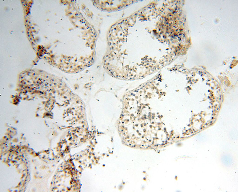 Immunohistochemical of paraffin-embedded human testis using Catalog No:109761(DCTN6 antibody) at dilution of 1:100 (under 10x lens)