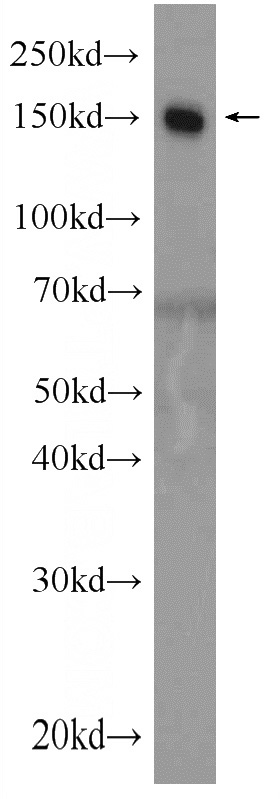 human blood tissue were subjected to SDS PAGE followed by western blot with Catalog No:109447(CFH Antibody) at dilution of 1:1000