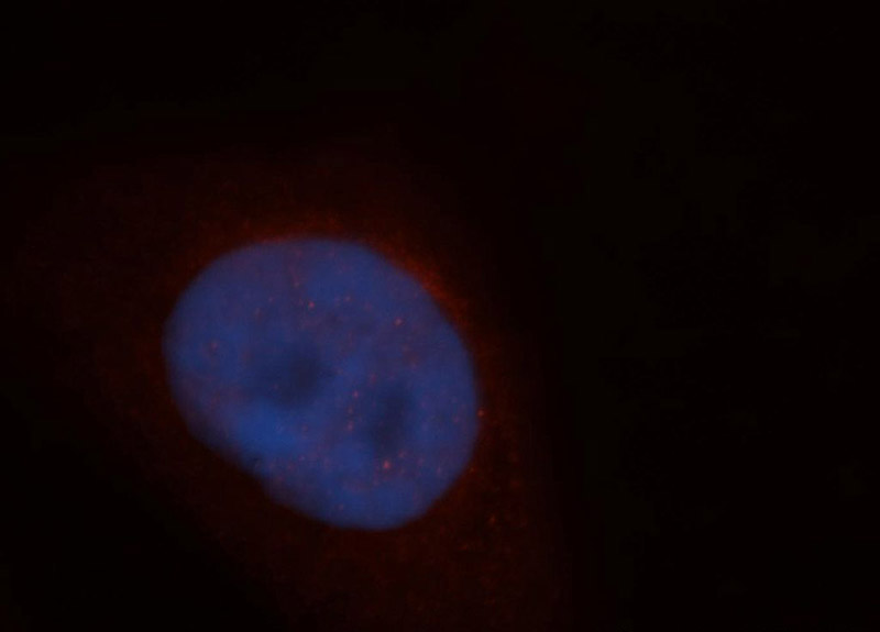 Immunofluorescent analysis of HepG2 cells, using ADAR antibody Catalog No:107774 at 1:50 dilution and Rhodamine-labeled goat anti-rabbit IgG (red). Blue pseudocolor = DAPI (fluorescent DNA dye).
