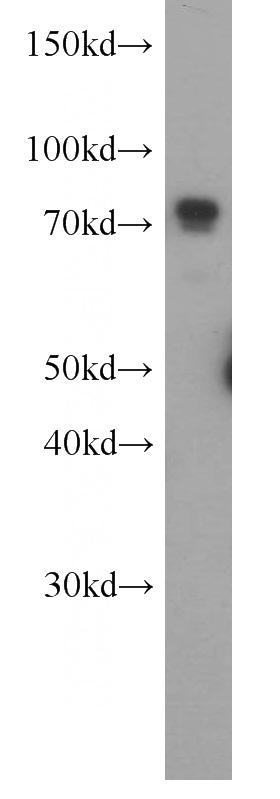 HeLa cells were subjected to SDS PAGE followed by western blot with Catalog No:116395(TRMT1 antibody) at dilution of 1:800