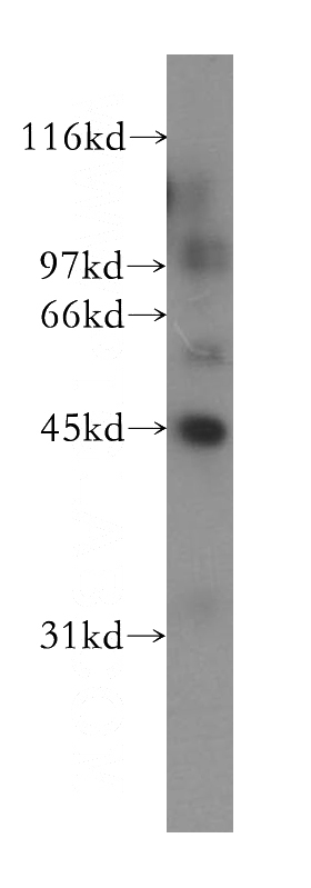 human kidney tissue were subjected to SDS PAGE followed by western blot with Catalog No:111637(IHH antibody) at dilution of 1:500