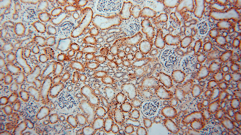 Immunohistochemical of paraffin-embedded human kidney using Catalog No:109921(DHRS1 antibody) at dilution of 1:50 (under 10x lens)