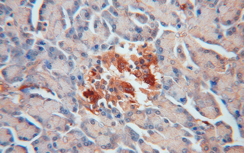 Immunohistochemical of paraffin-embedded human pancreas using Catalog No:109373(COL4A3BP antibody) at dilution of 1:50 (under 40x lens)