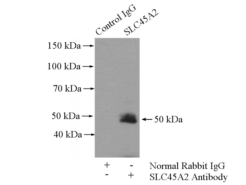 IP Result of anti-SLC45A2 (IP:Catalog No:115379, 4ug; Detection:Catalog No:115379 1:500) with HL-60 cells lysate 1600ug.