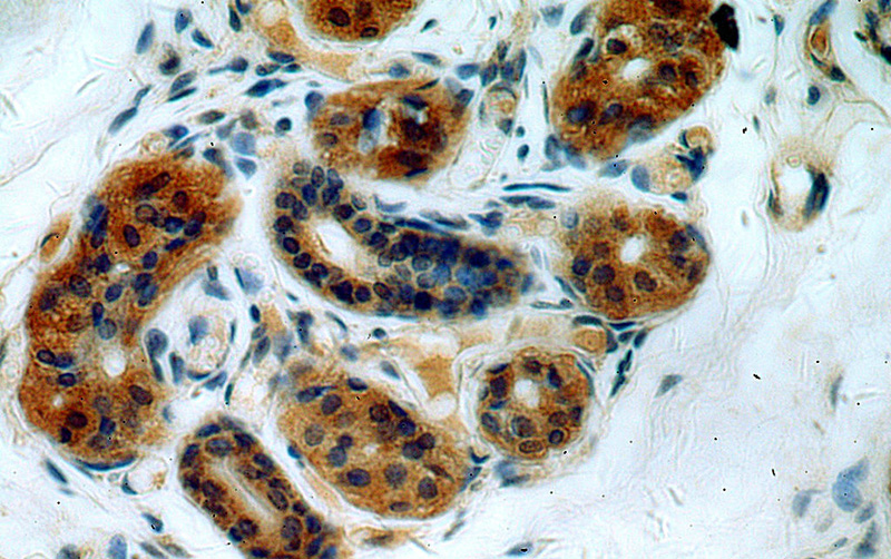 Immunohistochemical of paraffin-embedded human skin using Catalog No:107810(ABHD12B antibody) at dilution of 1:50 (under 40x lens)
