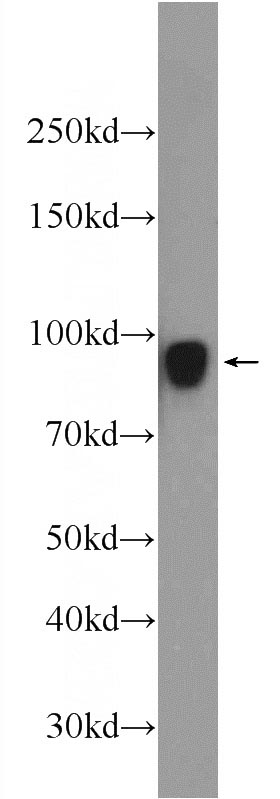 HeLa cells were subjected to SDS PAGE followed by western blot with Catalog No:115839(UNC84A Antibody) at dilution of 1:1000