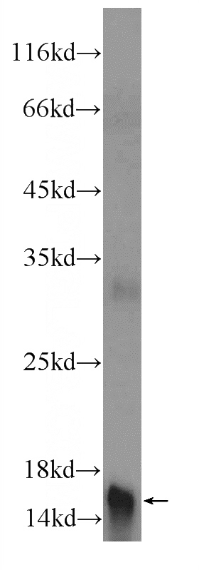 human placenta tissue were subjected to SDS PAGE followed by western blot with Catalog No:113930(PLAC1L Antibody) at dilution of 1:300