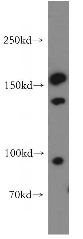 Jurkat cells were subjected to SDS PAGE followed by western blot with Catalog No:109044(CD11d antibody) at dilution of 1:800