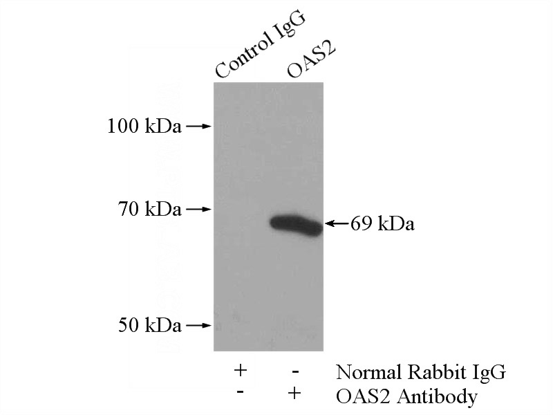 IP Result of anti-OAS2 (IP:Catalog No:113460, 4ug; Detection:Catalog No:113460 1:500) with Jurkat cells lysate 3600ug.