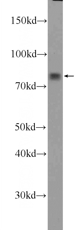 K-562 cells were subjected to SDS PAGE followed by western blot with Catalog No:112311(PRG2 Antibody) at dilution of 1:600