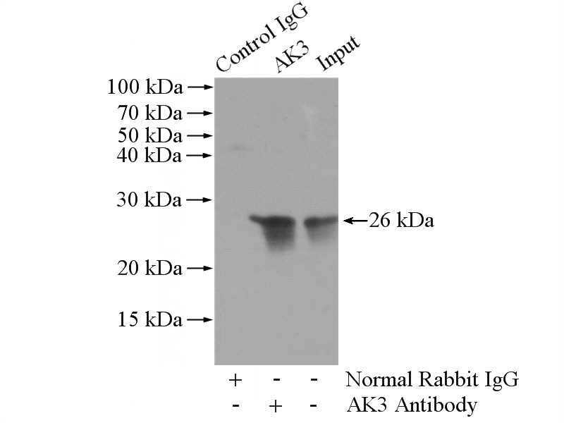 IP Result of anti-AK3 (IP:Catalog No:107924, 3ug; Detection:Catalog No:107924 1:500) with mouse kidney tissue lysate 4400ug.