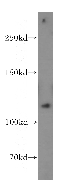 A431 cells were subjected to SDS PAGE followed by western blot with Catalog No:114030(PMS2 antibody) at dilution of 1:500