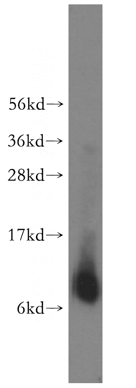 A375 cells were subjected to SDS PAGE followed by western blot with Catalog No:113069(NDUFB1 antibody) at dilution of 1:400