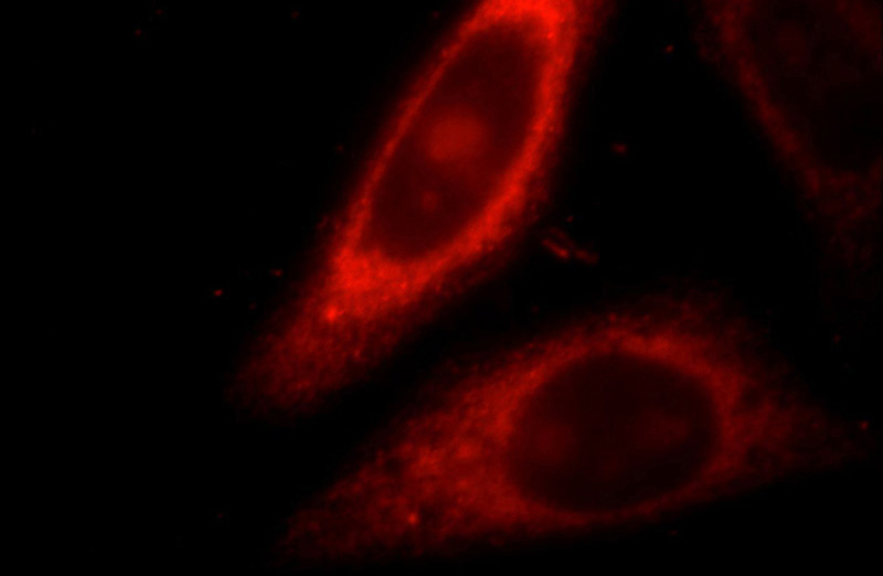 Immunofluorescent analysis of HepG2 cells, using IL1RAPL1 antibody Catalog No:111773 at 1:25 dilution and Rhodamine-labeled goat anti-rabbit IgG (red).