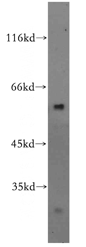 mouse brain tissue were subjected to SDS PAGE followed by western blot with Catalog No:116914(ZBTB37 antibody) at dilution of 1:500