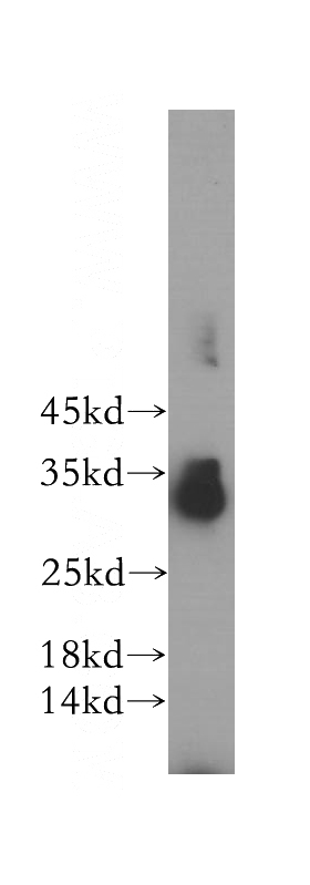 RAW264.7 cells were subjected to SDS PAGE followed by western blot with Catalog No:115649(SPRY3 antibody) at dilution of 1:600