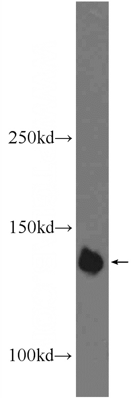 HeLa cells were subjected to SDS PAGE followed by western blot with Catalog No:113812(PHF20 Antibody) at dilution of 1:1000