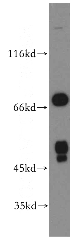 human liver tissue were subjected to SDS PAGE followed by western blot with Catalog No:110700(FOXJ3 antibody) at dilution of 1:800