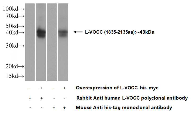 Transfected HEK-293 cells were subjected to SDS PAGE followed by western blot with Catalog No:112396(L-VocC Antibody) at dilution of 1:2000