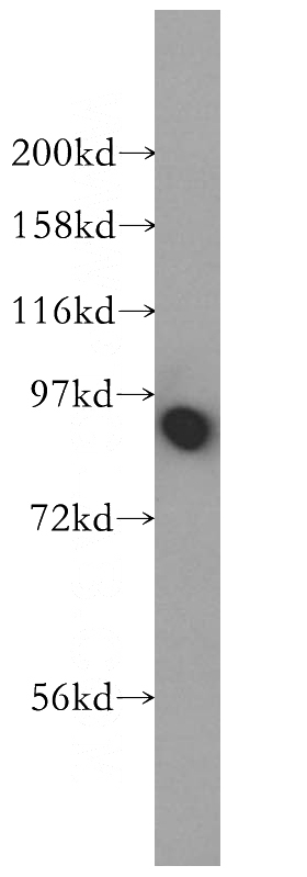 mouse brain tissue were subjected to SDS PAGE followed by western blot with Catalog No:108832(CANX antibody) at dilution of 1:400
