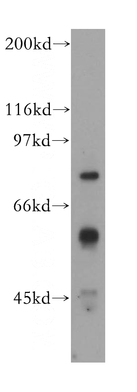 A431 cells were subjected to SDS PAGE followed by western blot with Catalog No:111626(IFNAR1 antibody) at dilution of 1:600