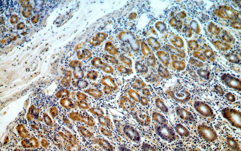 Immunohistochemical of paraffin-embedded human stomach using Catalog No:112847(MRPS2 antibody) at dilution of 1:100 (under 10x lens)