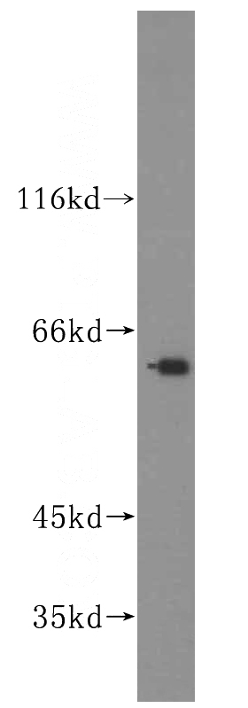mouse testis tissue were subjected to SDS PAGE followed by western blot with Catalog No:110846(GALNT14 antibody) at dilution of 1:400
