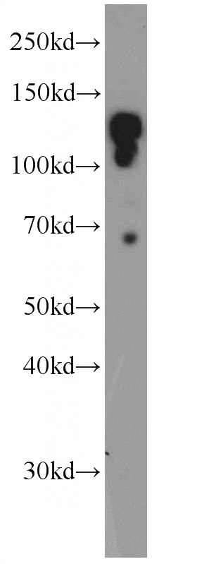 mouse testis tissue were subjected to SDS PAGE followed by western blot with Catalog No:117082(AZI1 Antibody) at dilution of 1:1000
