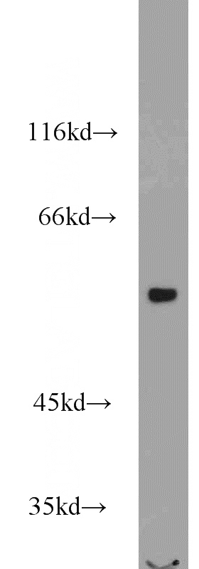 mouse skeletal muscle tissue were subjected to SDS PAGE followed by western blot with Catalog No:116796(VPS72 antibody) at dilution of 1:800