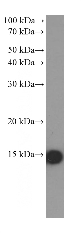 A375 cells were subjected to SDS PAGE followed by western blot with Catalog No:107198(FABP5 Antibody) at dilution of 1:8000