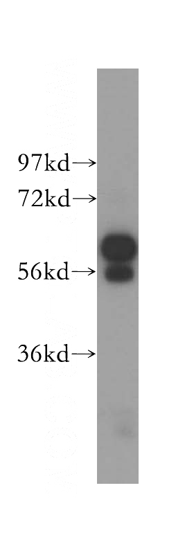mouse brain tissue were subjected to SDS PAGE followed by western blot with Catalog No:109574(DPYSL5 antibody) at dilution of 1:1000