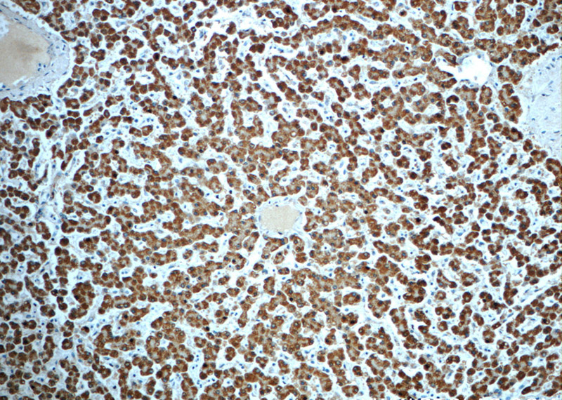 Immunohistochemistry of paraffin-embedded human liver slide using Catalog No:113686(PCCA Antibody) at dilution of 1:50