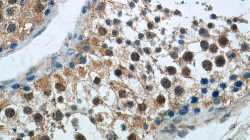 Immunohistochemical of paraffin-embedded human testis using Catalog No:108132(ANAPC1 antibody) at dilution of 1:50 (under 40x lens)