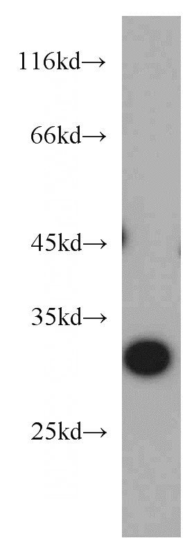 mouse kidney tissue were subjected to SDS PAGE followed by western blot with Catalog No:115326(SLC25A2 antibody) at dilution of 1:500