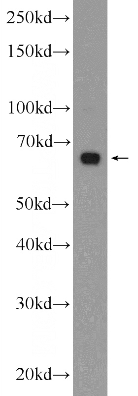 mouse liver tissue were subjected to SDS PAGE followed by western blot with Catalog No:115312(SLC22A1 Antibody) at dilution of 1:600