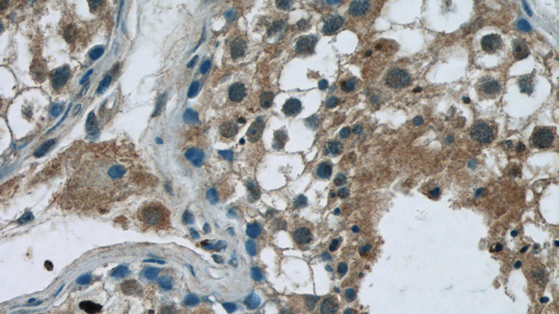 Immunohistochemistry of paraffin-embedded human testis tissue slide using Catalog No:111170(GSK3B Antibody) at dilution of 1:50 (under 40x lens)
