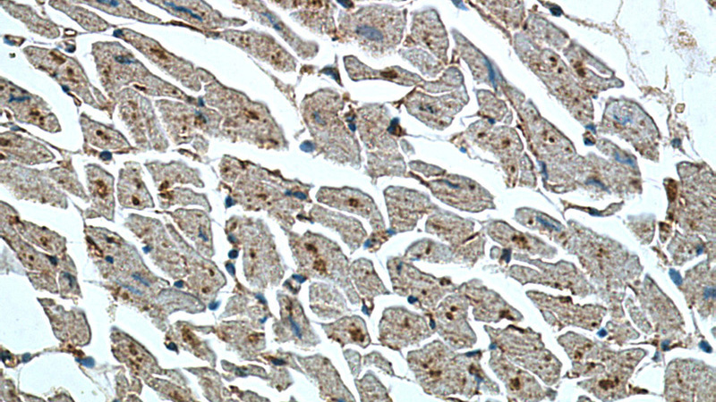 Immunohistochemistry of paraffin-embedded human heart tissue slide using Catalog No:113306(NOSTRIN Antibody) at dilution of 1:200 (under 40x lens).
