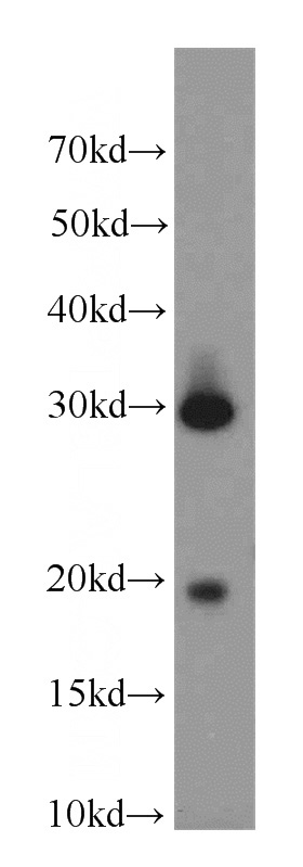 human testis tissue were subjected to SDS PAGE followed by western blot with Catalog No:109614(CST8 antibody) at dilution of 1:1000
