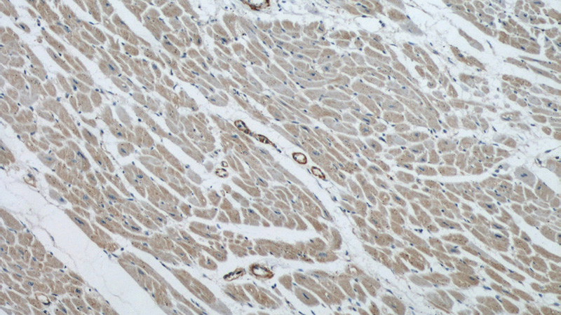 Immunohistochemical of paraffin-embedded human heart using Catalog No:116239(TOM70 antibody) at dilution of 1:50 (under 10x lens)