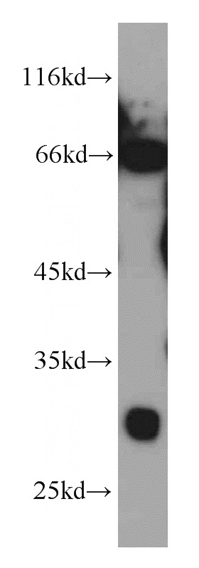 A549 cells were subjected to SDS PAGE followed by western blot with Catalog No:111848(INSIG1 antibody) at dilution of 1:1000