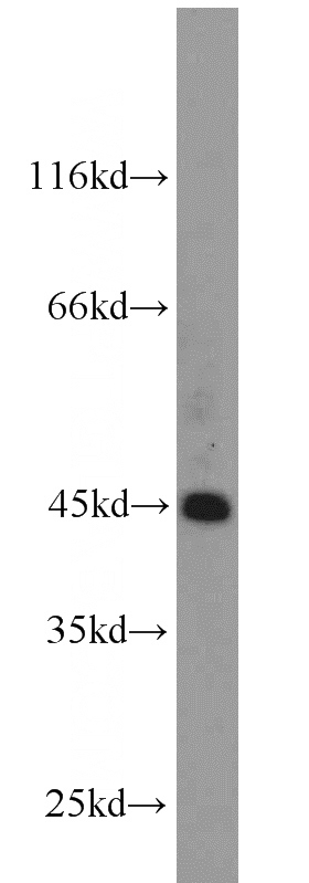 HeLa cells were subjected to SDS PAGE followed by western blot with Catalog No:117032(ZNF763 antibody) at dilution of 1:1000