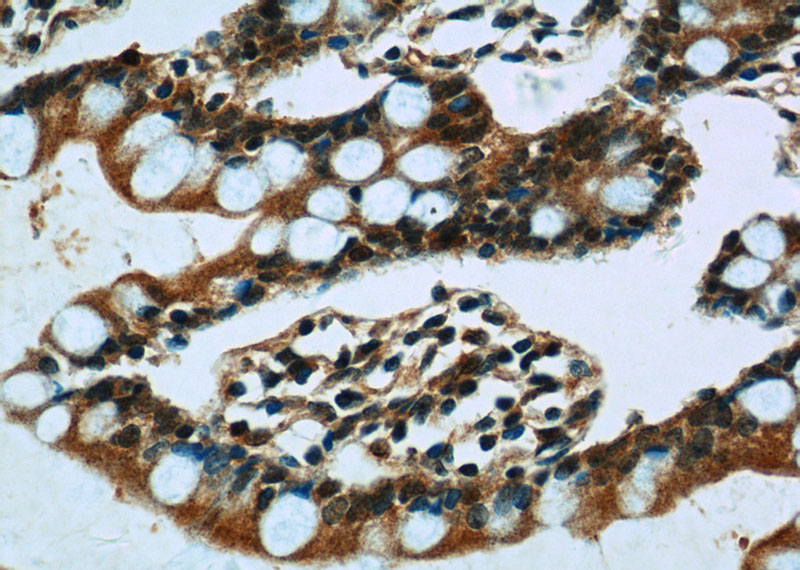 Immunohistochemistry of paraffin-embedded human small intestine tissue slide using Catalog No:109388(CLIC1 Antibody) at dilution of 1:50 (under 40x lens)