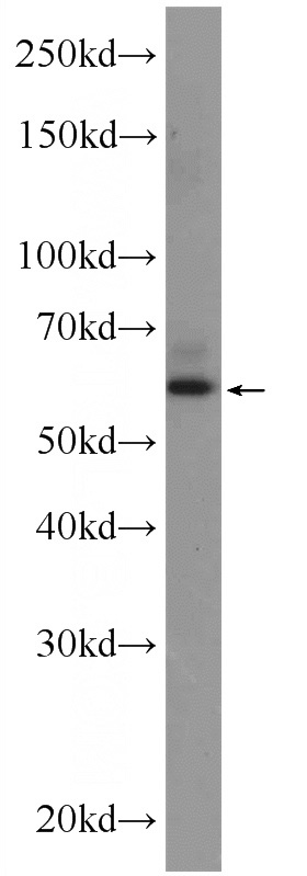C6 cells were subjected to SDS PAGE followed by western blot with Catalog No:117252(ZNF846 Antibody) at dilution of 1:600